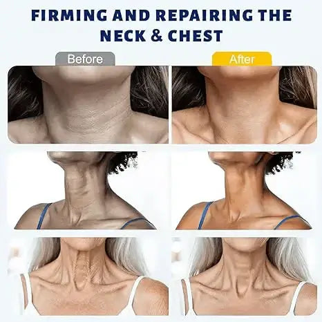 😍 Instant Neck Lift Cream — 🧴 Infused with Retinol & Hyaluronic Acid | Firms the Neck, Reduces Wrinkles & Double Chin