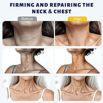😍 Instant Neck Lift Cream — 🧴 Infused with Retinol & Hyaluronic Acid | Firms the Neck, Reduces Wrinkles & Double Chin