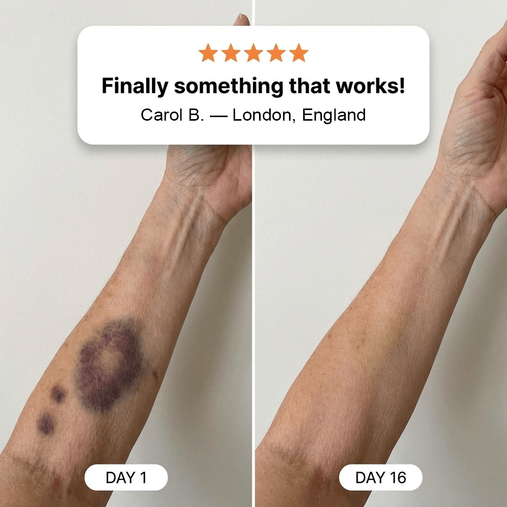 Day 1 and Day 16 forearm comparison with five-star customer quote